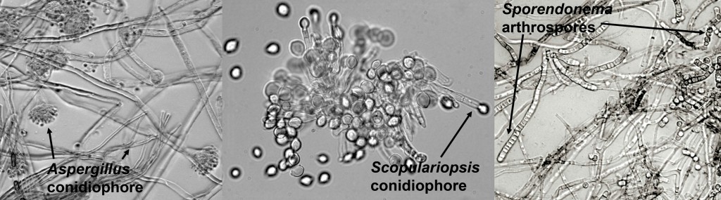 Examples of different spore morphologies that one can observe under a compound microscope.