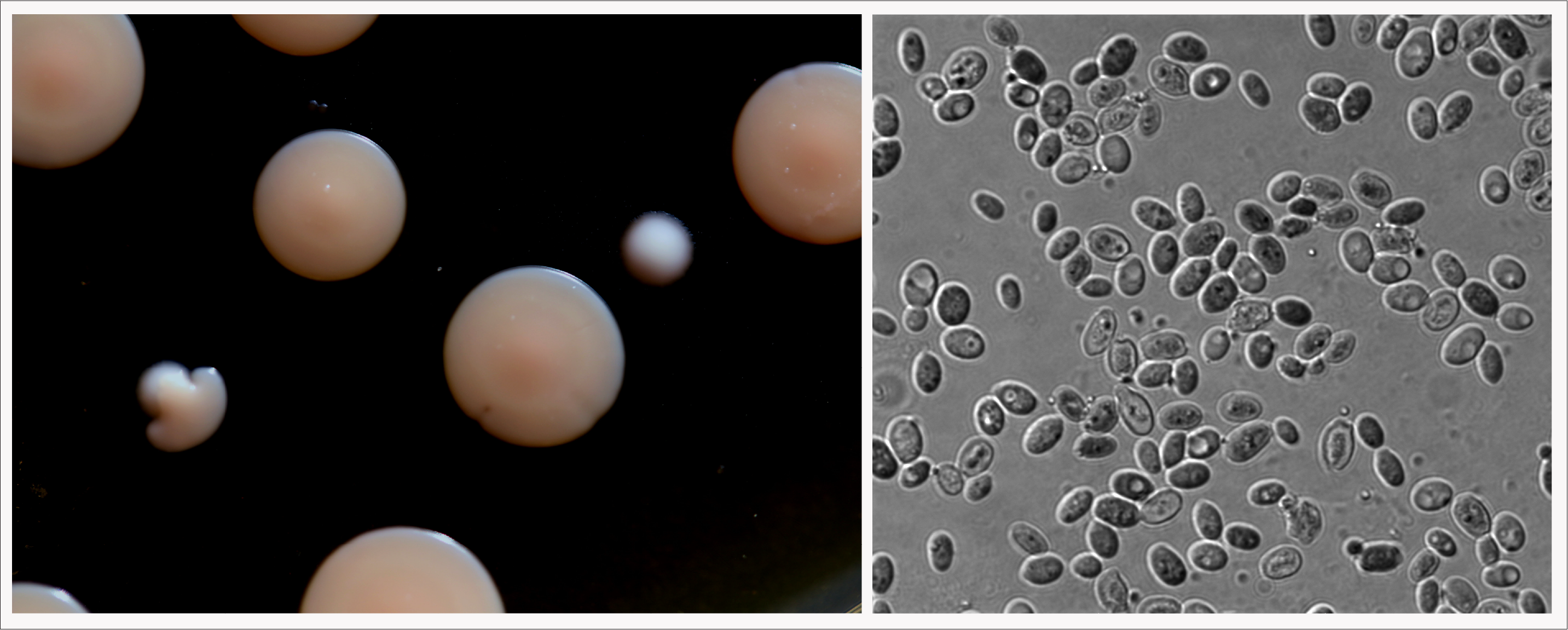 Left: K. barnettii  growing as colonies.  Both the large pink colonies and the small white colonies are K. barnettii  Right: K. barnettii cells at magnification.