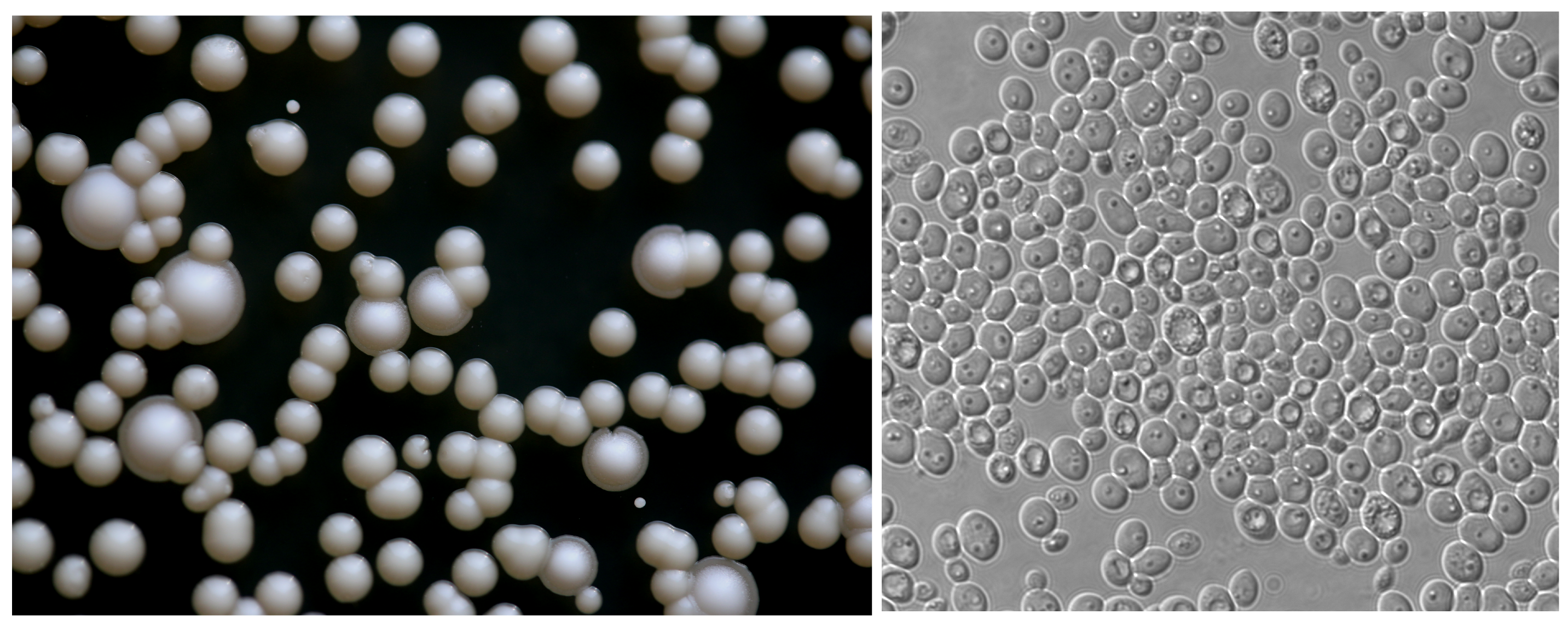 Left: K. naganishii  growing as colonies.  The smaller shiny colonies (without rings around them) are K. naganishii  Right: K. naganishii cells at magnification. 