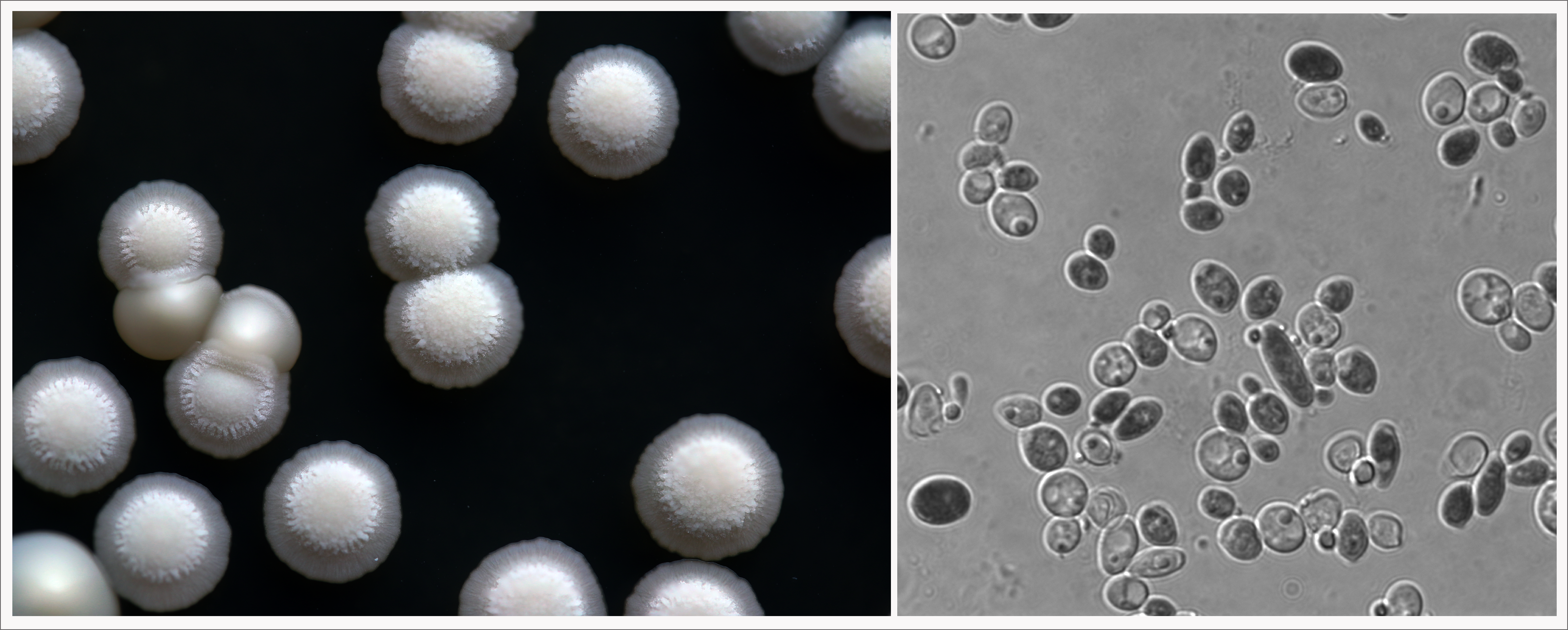 Left: W. anomalus are the highly textured white colonies.  Right: W. anomalus cells at magnification. 